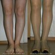 Пластический хирург в Алматы в Алматах